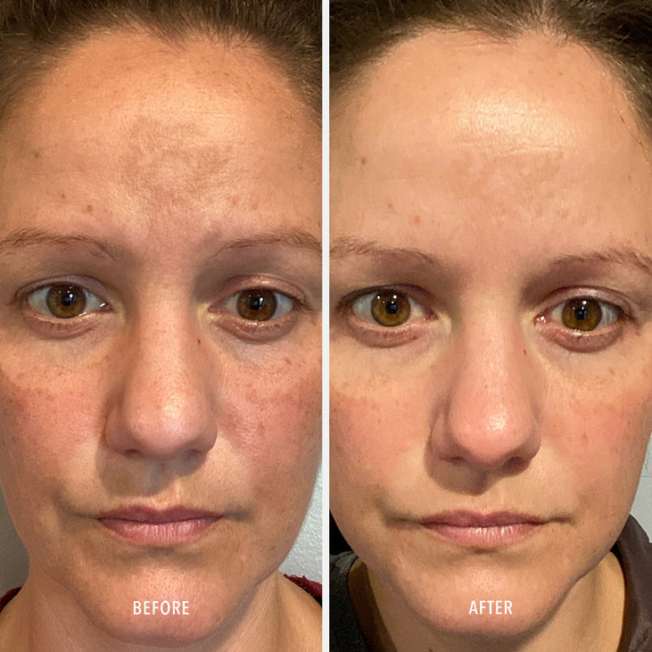 Firma-Bright | HydroPeptide