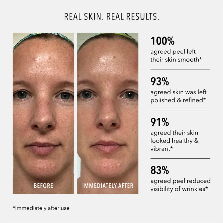 Polish & Plump Face Peel Kit | HydroPeptide