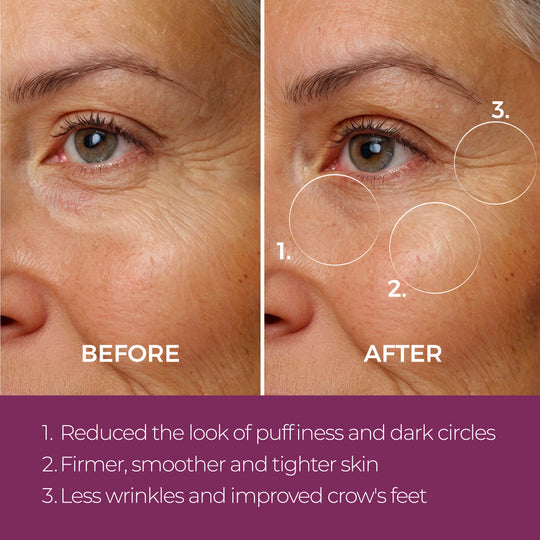 Eye Repair Peptide Complex | blinc