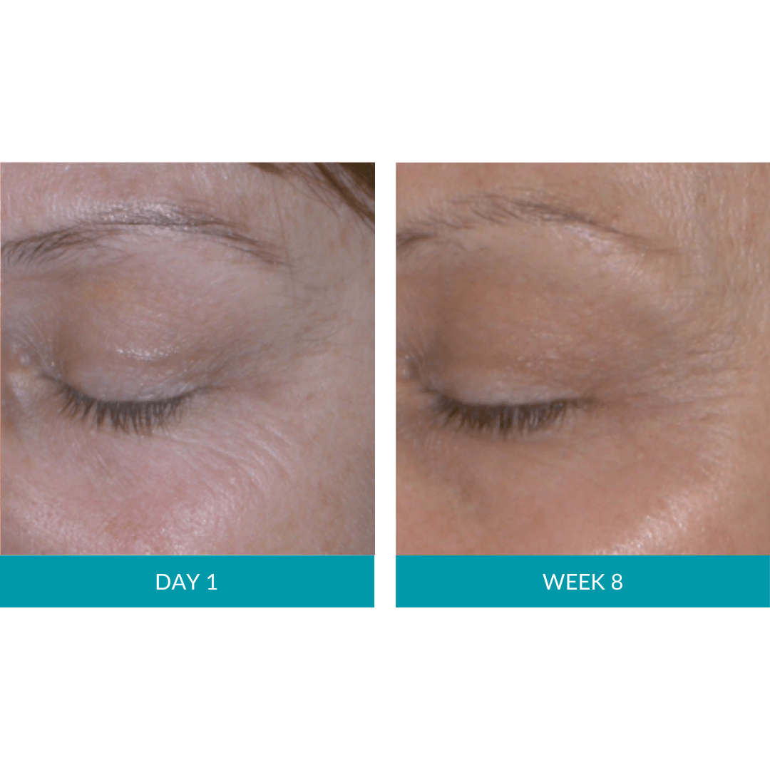 Glo Mask Anti-Aging LED Phototherapy Mask | Glo910