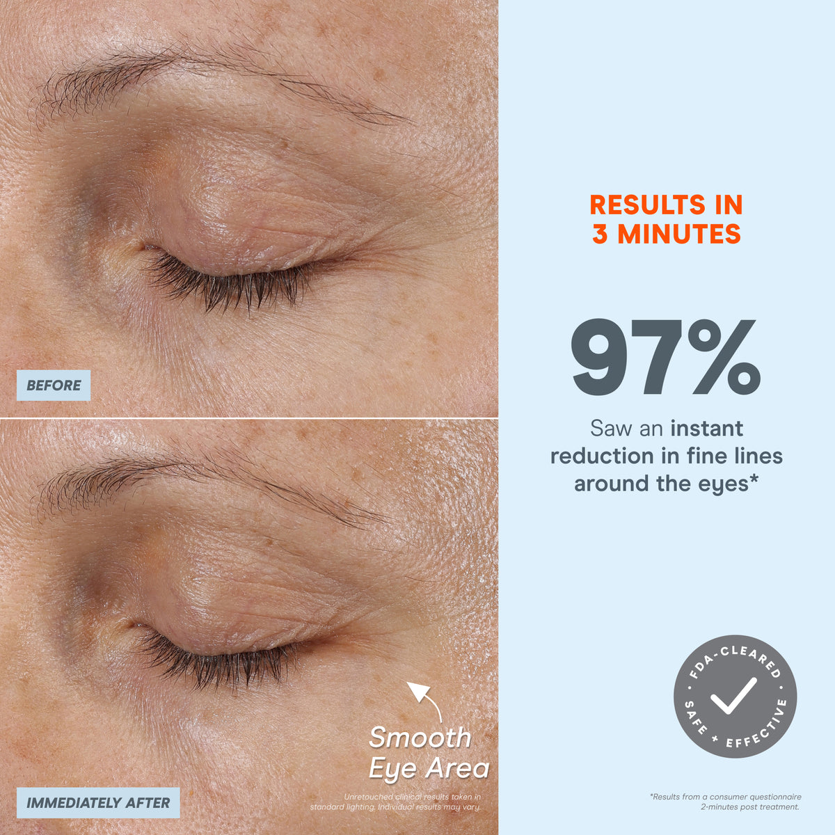 FIX MicroWand | Nuface