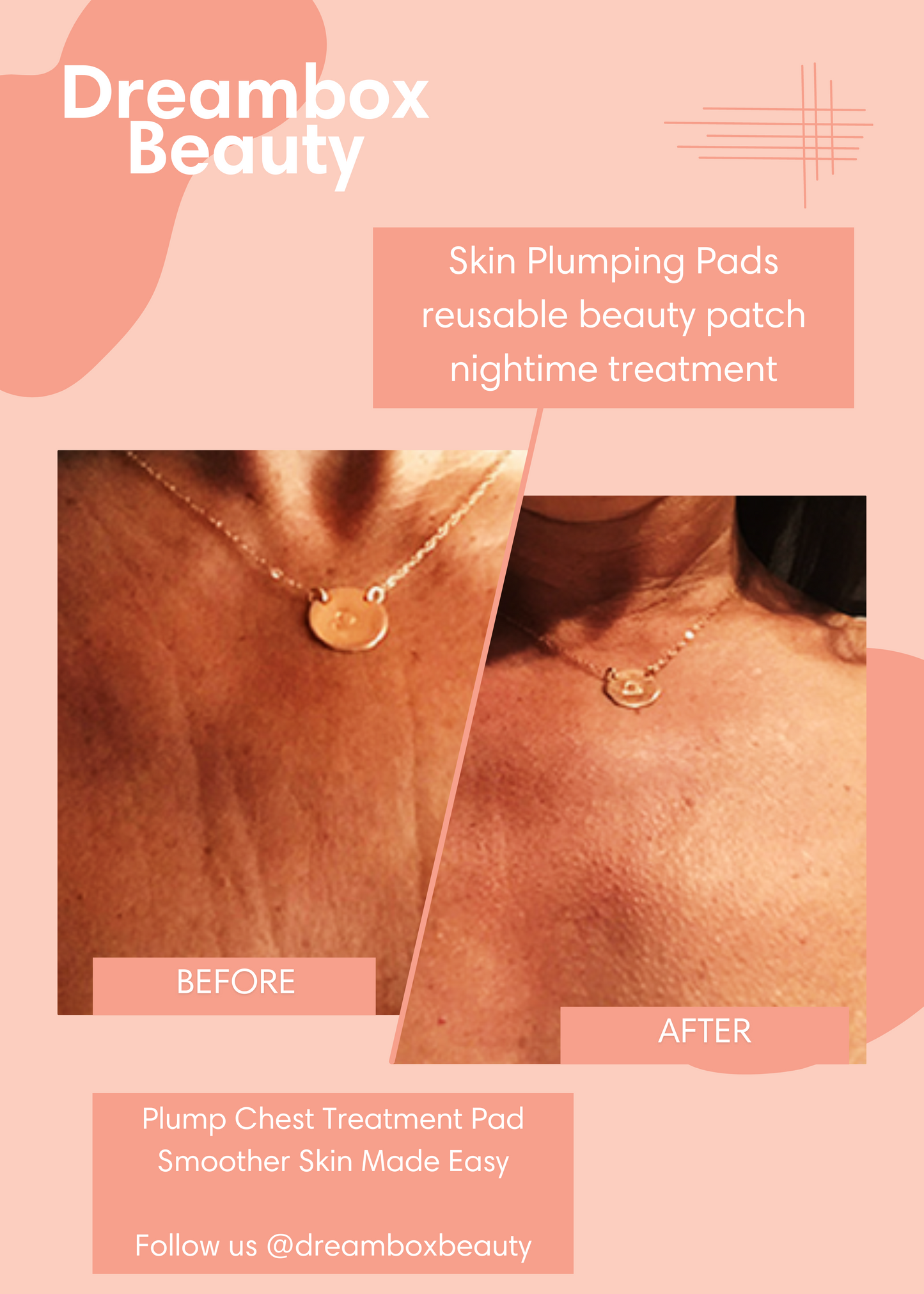 Skin Plumping Reusable Chest Pad | Dreambox Beauty