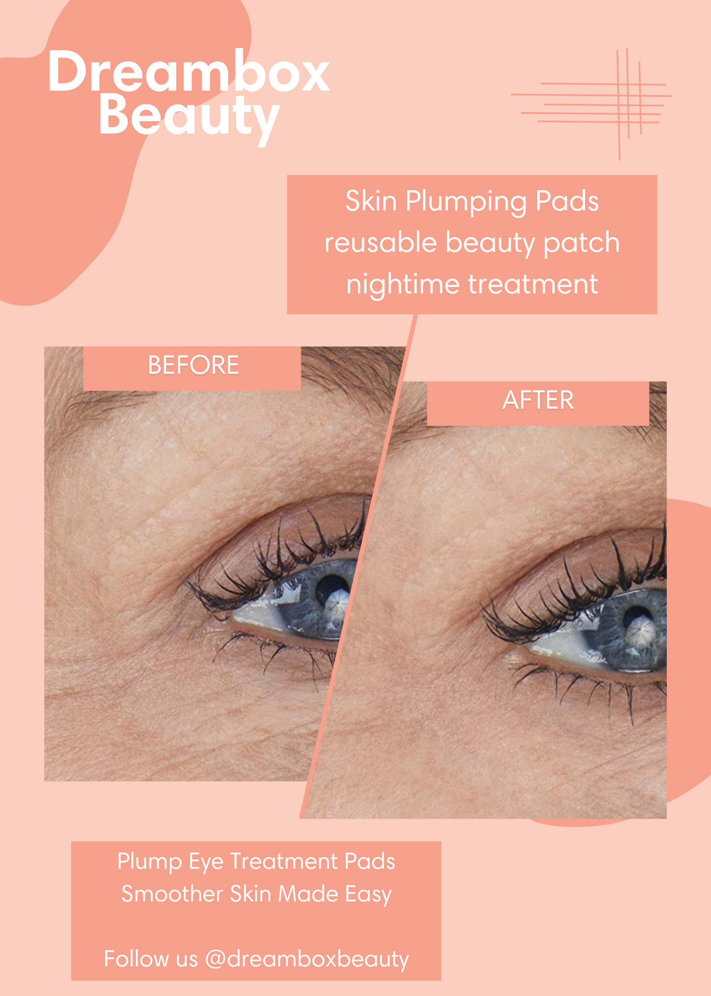 Skin Plumping Reusable Under Eye Pads | Dreambox Beauty