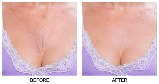 Skin Plumping Reusable Chest Pad | Dreambox Beauty