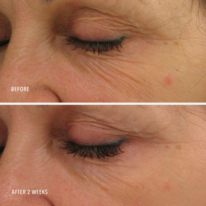 Power Lift | HydroPeptide