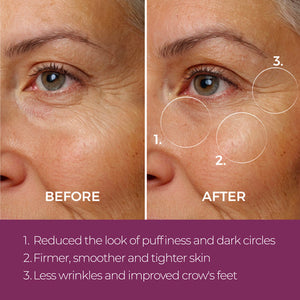 Eye Repair Peptide Complex | blinc