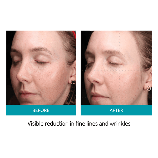 Glo Mask Anti-Aging LED Phototherapy Mask | Glo910