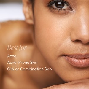 Close-up of a woman with smooth skin highlighting skincare benefits for acne, acne-prone, oily, or combination skin, promoting Daytime Control Oil Reducer Circadia.