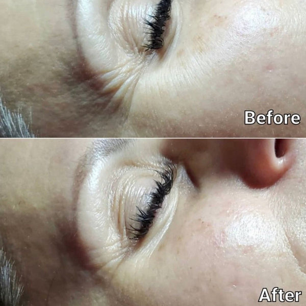 Dramatic Eye Lift | Skin Authority
