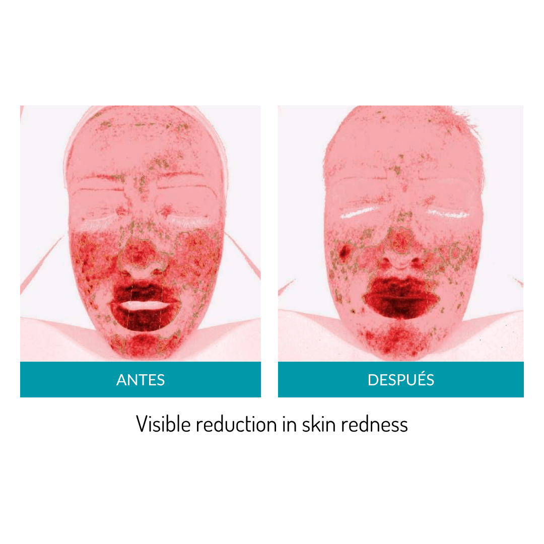 Glo Mask Anti-Aging LED Phototherapy Mask | Glo910