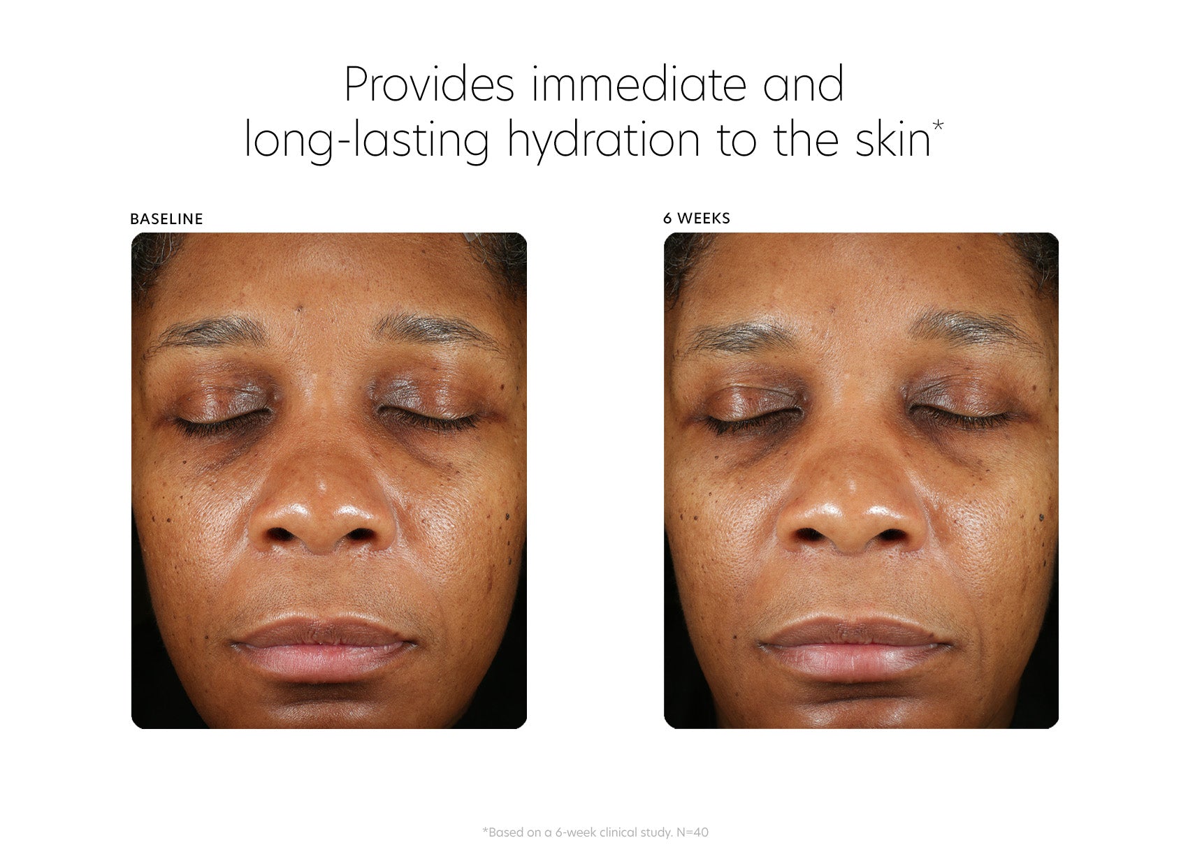 Hyaluronic Acid Boosting Serum | PCA Skin