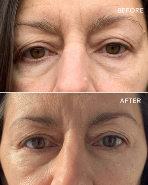 First Light Vitamin C + Caffeine Eye Cream | Three Ships