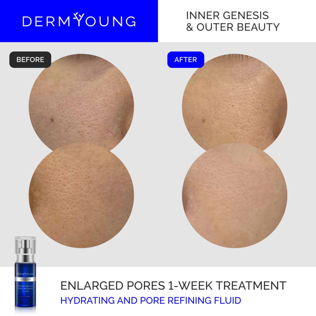 I-Genesis Hydrating and Pore Refining Fluid | DermYoung