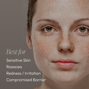 Close-up of a woman with sensitive skin showing natural freckles and mild redness, highlighting skin concerns treated by Sensitive Regimen Bundle | Circadia for rosacea, irritation, and compromised barrier.