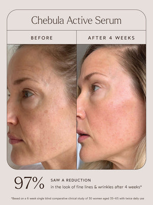 Before and after comparison showing visible improvement in skin texture and reduction of fine lines after 4 weeks using Chebula Active Serum | True Botanicals.