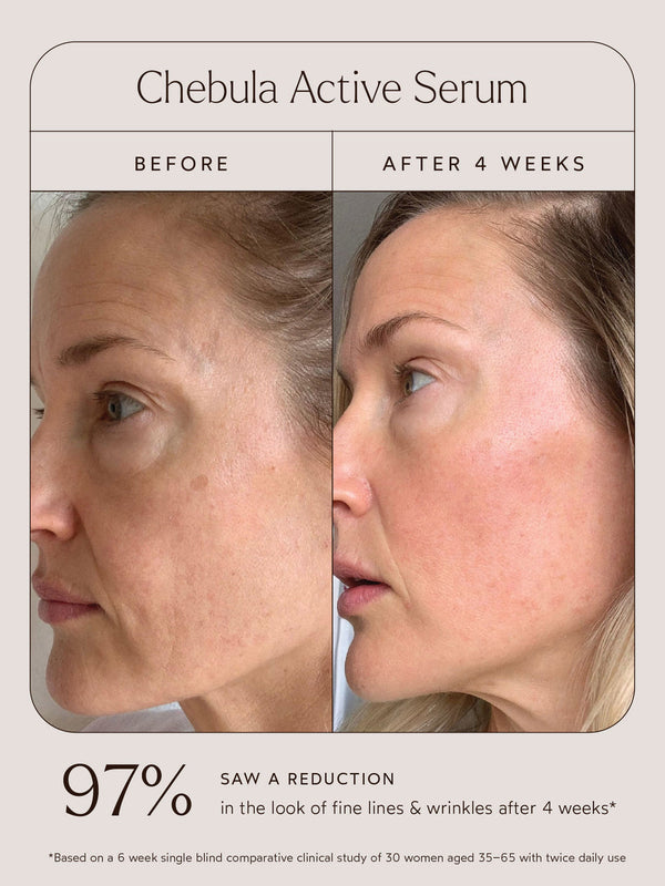 Before and after comparison showing visible improvement in skin texture and reduction of fine lines after 4 weeks using Chebula Active Serum | True Botanicals.