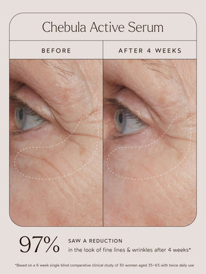 Close-up comparison of a person's eye area showing visible reduction in fine lines and wrinkles after 4 weeks of using Chebula Active Serum | True Botanicals, highlighting skincare improvement.
