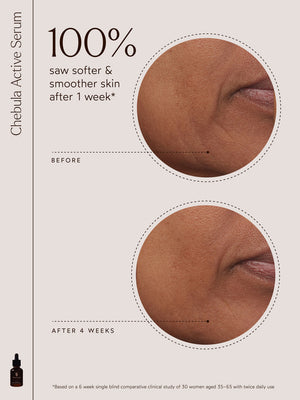 Close-up comparison of facial skin texture before and after 4 weeks of using Chebula Active Serum | True Botanicals, showing visibly smoother and softer skin.