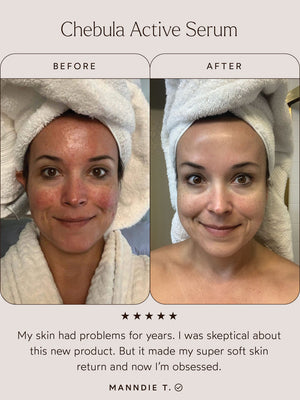 Before and after comparison photo of a woman with a towel wrapped on her head showing clearer, smoother skin after using Chebula Active Serum | True Botanicals, highlighting skincare improvement.