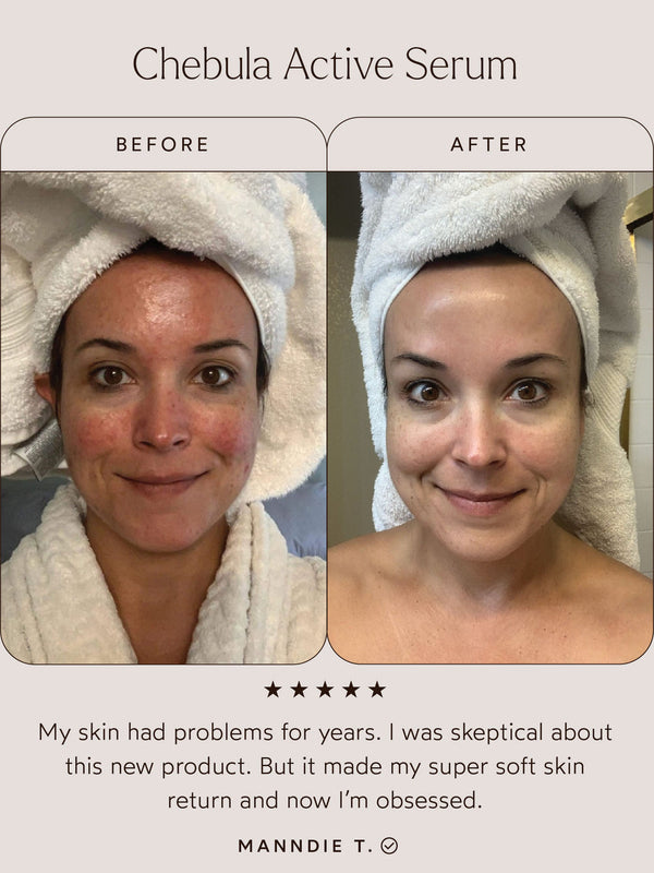 Before and after comparison photo of a woman with a towel wrapped on her head showing clearer, smoother skin after using Chebula Active Serum | True Botanicals, highlighting skincare improvement.