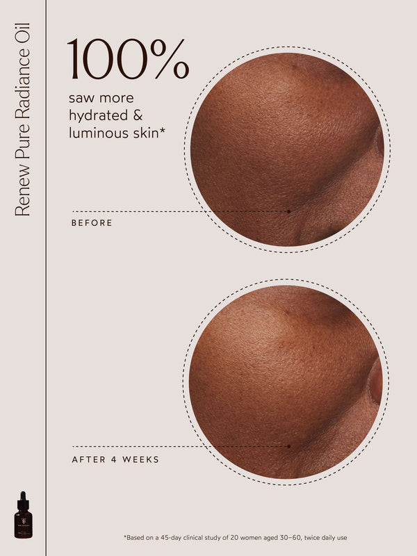 Close-up comparison of skin before and after 4 weeks of using Renew Pure Radiance Oil | True Botanicals, showing improved hydration and luminous skin.