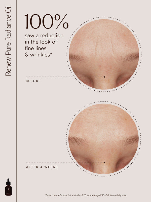 Comparison of forehead skin showing visible reduction in fine lines and wrinkles after 4 weeks of using Renew Pure Radiance Oil | True Botanicals in skincare routine.