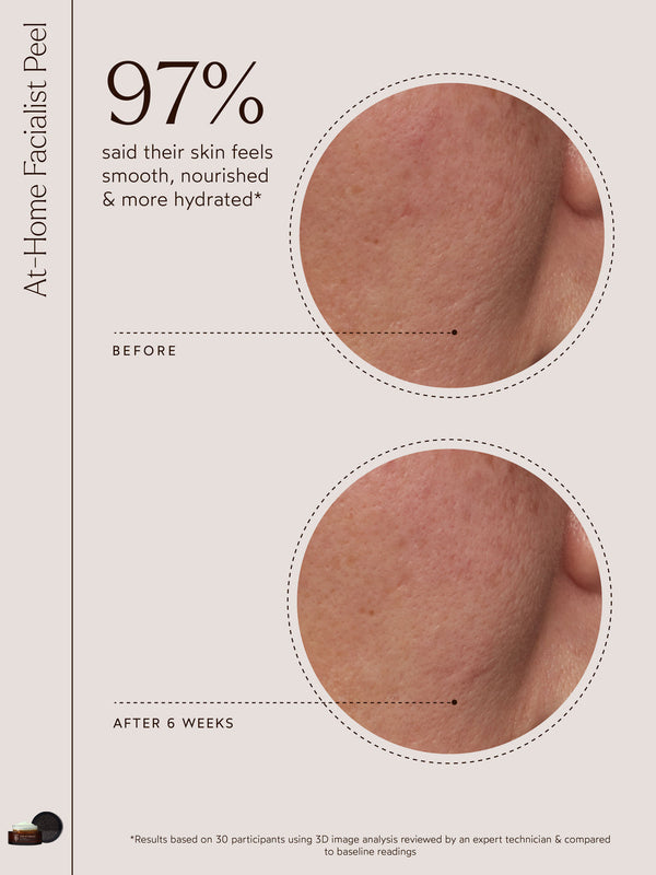 Comparison of skin texture and hydration before and after 6 weeks of using At-Home Facialist Peel | True Botanicals, showing smoother, nourished skin with 97% satisfaction.