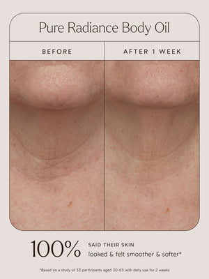 Comparison of neck skin texture before and after one week of using Pure Radiance Body Oil | True Botanicals, showing visibly smoother and softer skin.