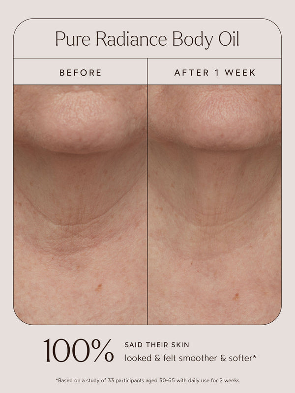 Comparison of neck skin texture before and after one week of using Pure Radiance Body Oil | True Botanicals, showing visibly smoother and softer skin.