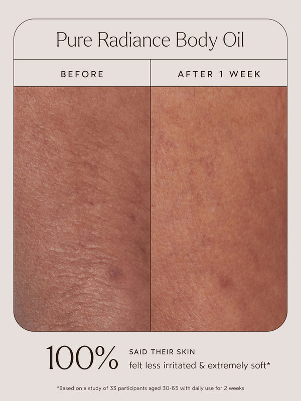 Close-up comparison of skin texture before and after one week of using Pure Radiance Body Oil | True Botanicals, showing visibly softer and less irritated skin.