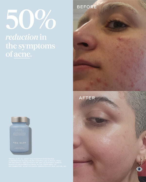 Clear Capsules | VIDA GLOW